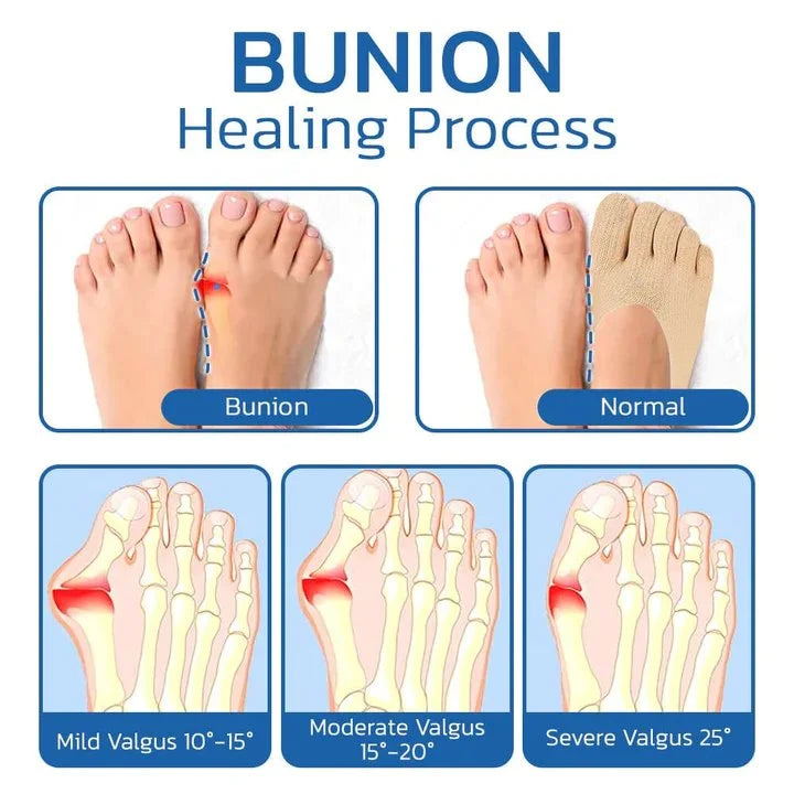 防拇囊炎保健襪 Anti Bunions Health Sock